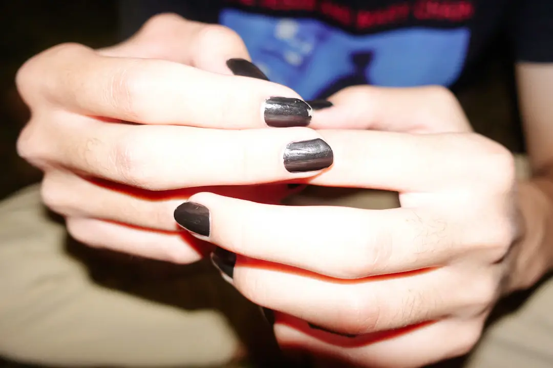 Die häufigsten Nagelprobleme und wie man sie ganz einfach behebt