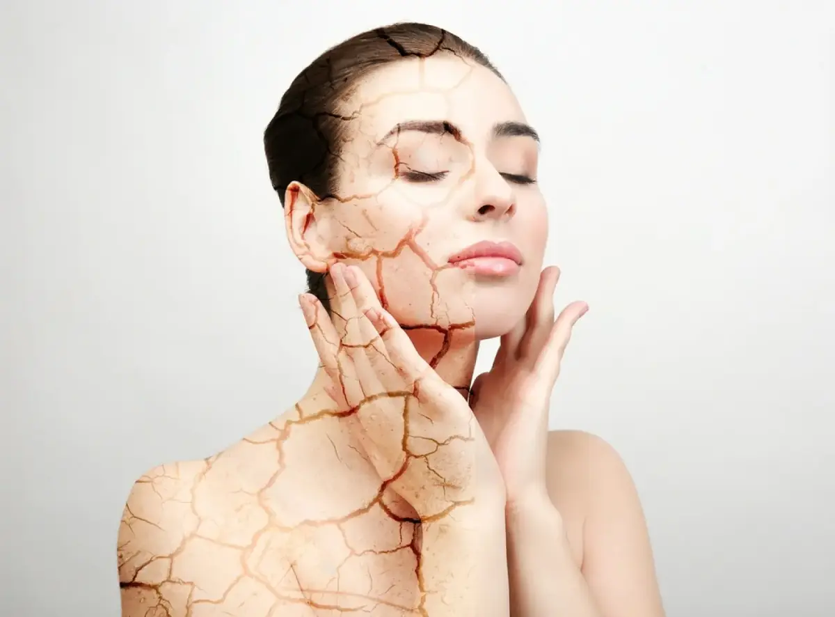 Frau mit trockener Haut; Herbstliche Schönheit: Tipps für strahlende Haut und glänzendes Haar