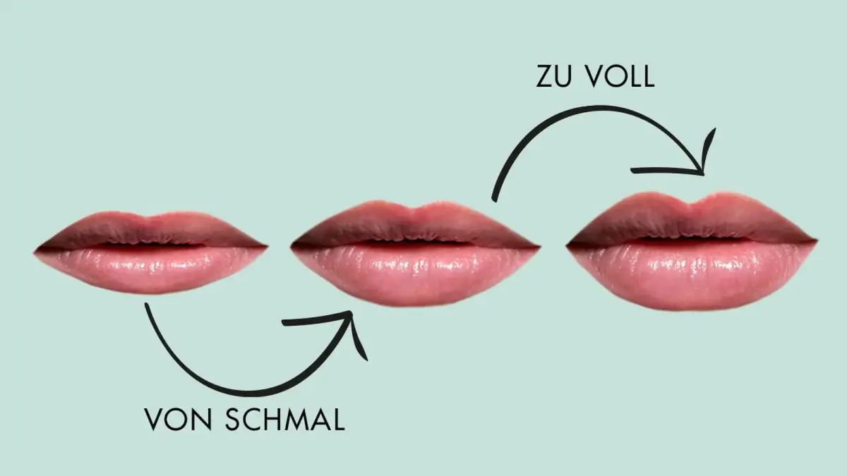 Lippenaufspritzung Erfahrungen - Beautycenter by Neta, St. Gallen